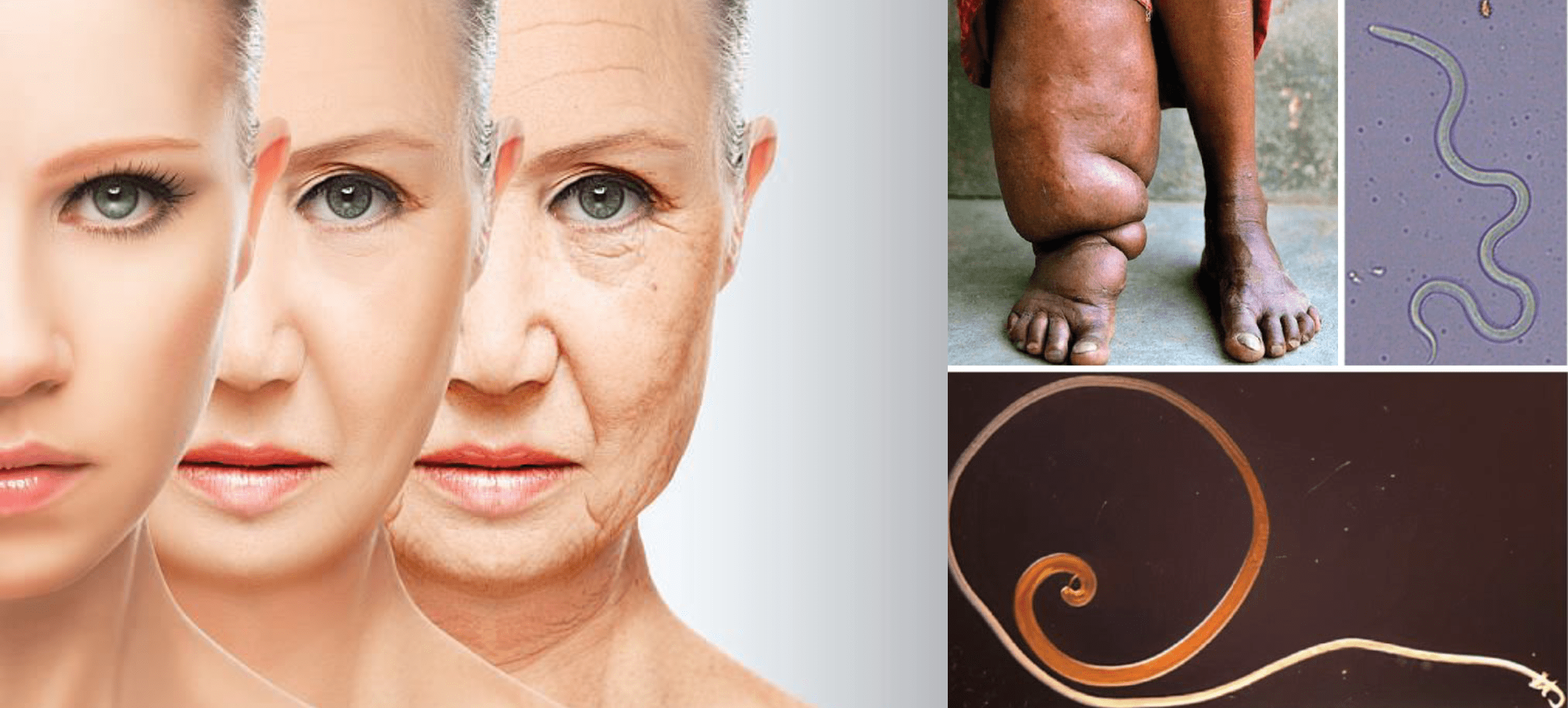 woman ageing and a parasitic worm